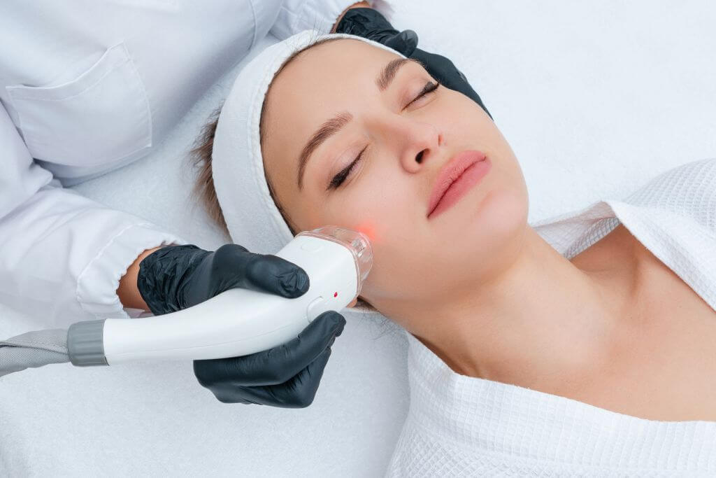 Depilación IPL profesional